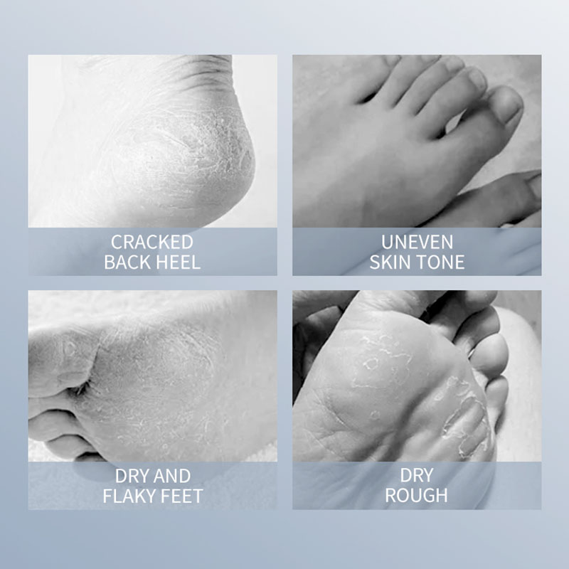 SADOER Keçi Sütü Ayak Maskesi  - Foot Mask Peeling incelemesi ve fiyatı