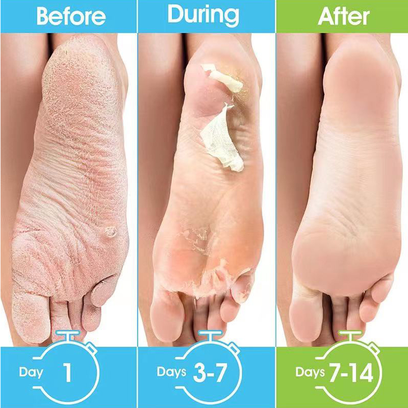 1 Pag=1 Çift Bal Özlü Ayak Mas - Foot Mask Peeling incelemesi ve fiyatı