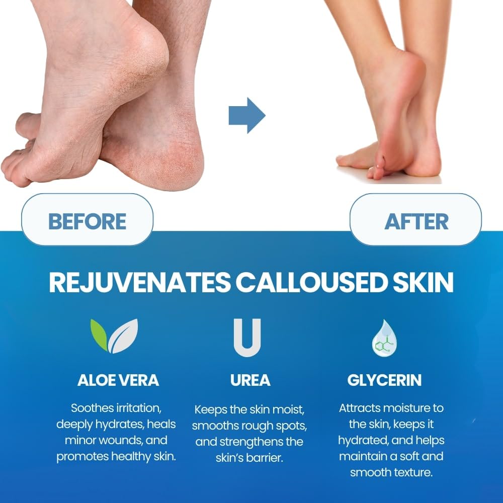 Ayak Tırnak Eti Temizleyici Öl - Foot Mask Peeling incelemesi ve fiyatı