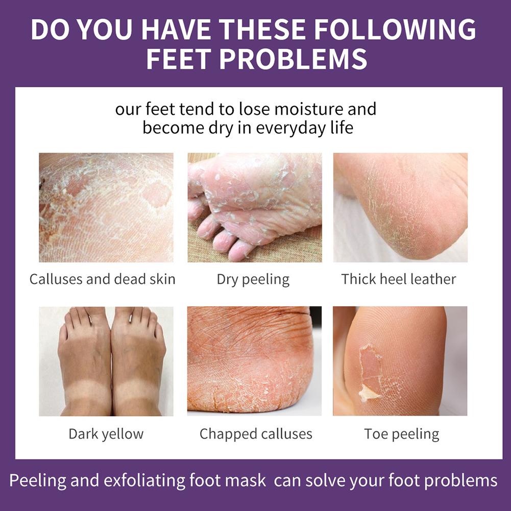 Lavanta Özlü Ayak Maskesi Cilt - Foot Mask Peeling incelemesi ve fiyatı