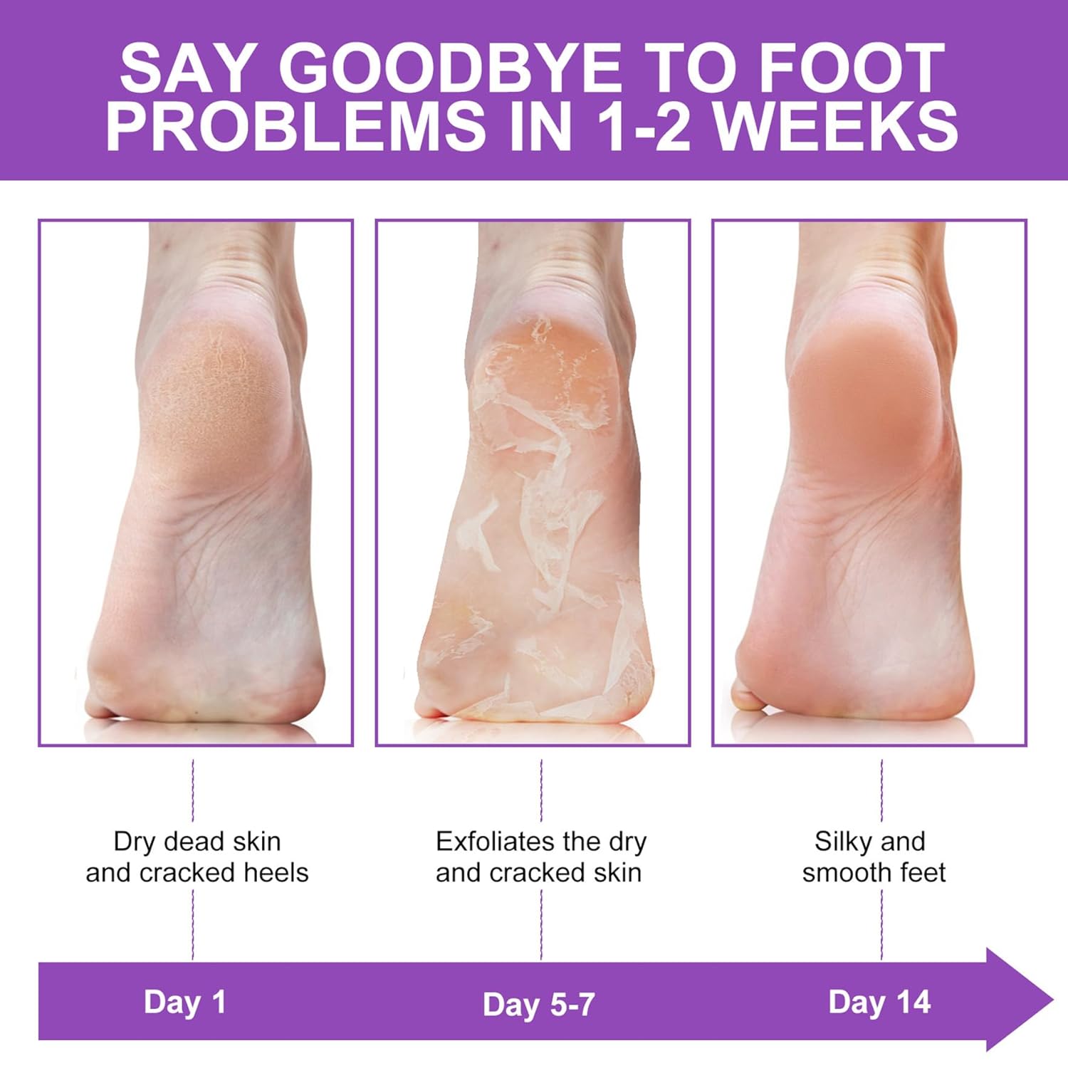Peeling Çorabı Nasır Ölü Deri  - Foot Mask Peeling incelemesi ve fiyatı