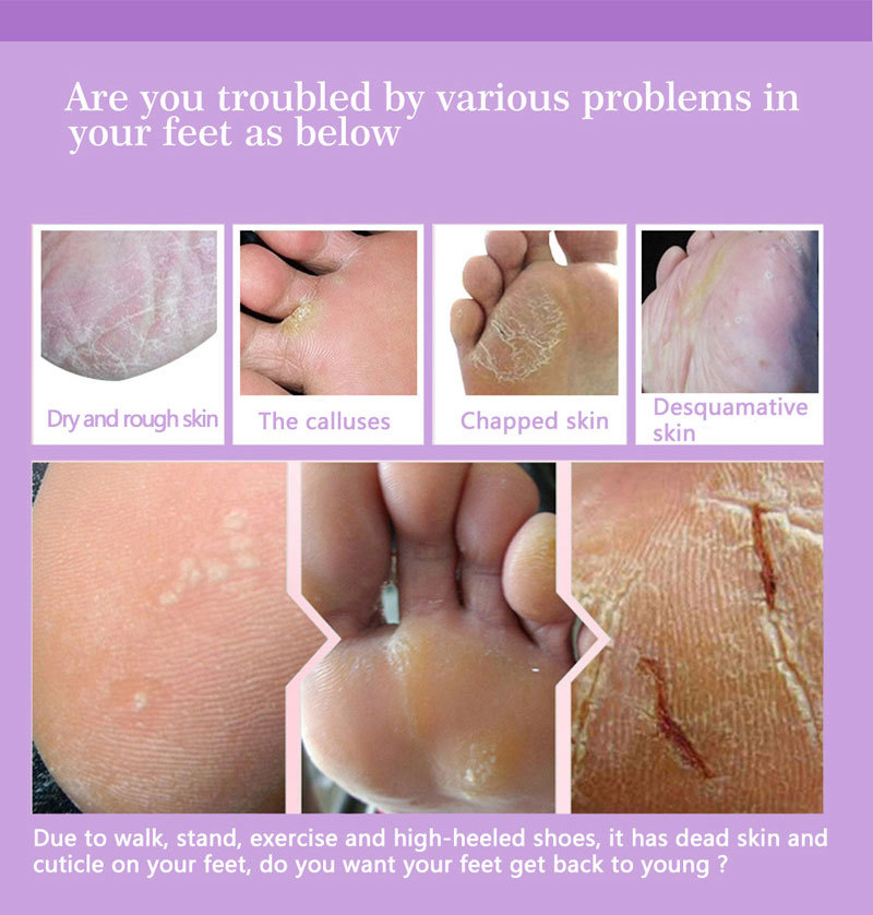 Ayak Peeling Maskeleri Pedikür - Foot Mask Peeling incelemesi ve fiyatı