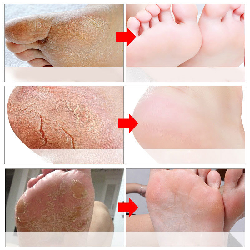 Ayak Peeling Maskeleri Pedikür - Foot Mask Peeling incelemesi ve fiyatı