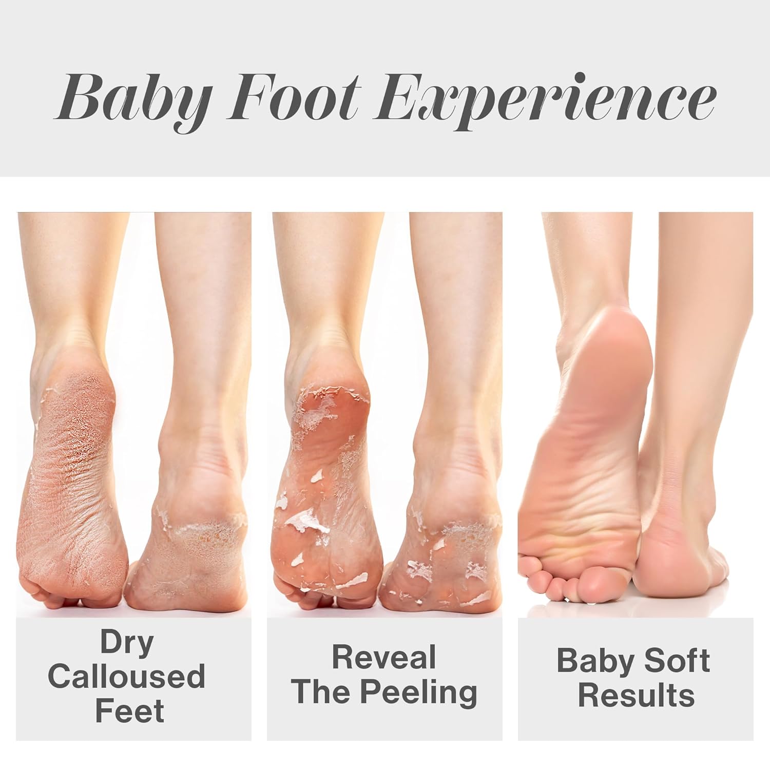 Peeling Çorapları Nasır Ölü De - Foot Mask Peeling incelemesi ve fiyatı